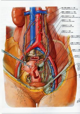 卵巣　子宮周辺587.jpg